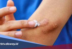 Cara Mengatasi dan Menghilangkan Bekas Luka Agar Kulit Kembali Mulus