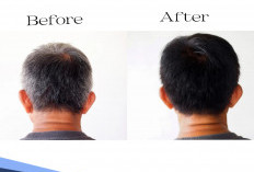 Bukan Dicat Apalagi Disemir, Ini Cara Menghilangkan Uban dengan Bahan Alami