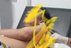 Kades Padang Genteng Kaur Kena Bacok, Lengan dan Punggung Terluka